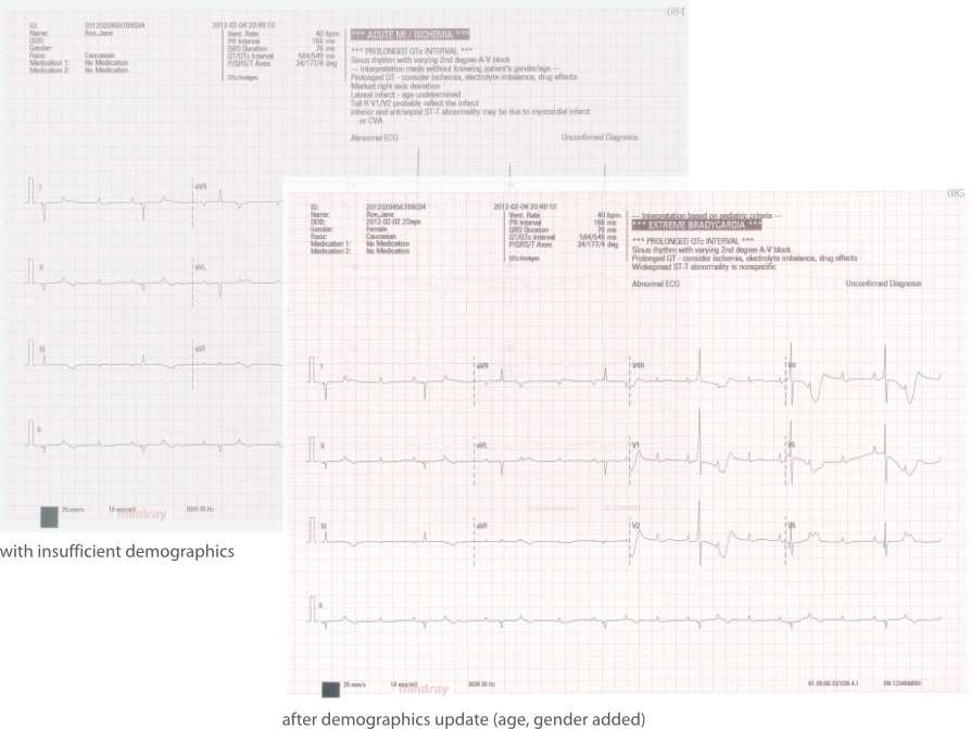 Electrocardiografo marca Mindray Modelo BENEHEART R12