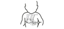 Electrocardiografo marca Mindray Modelo BENEHEART R12