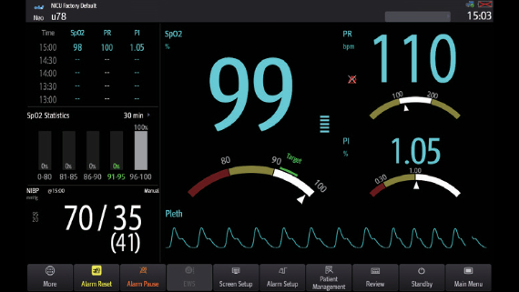 Monitor de Signos Vitales preconfigurado marca Mindray, modelo ePM 12 Avanzado