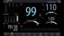 Monitor de Signos Vitales preconfigurado marca Mindray, modelo ePM 12 Avanzado