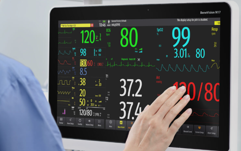 Monitor de Signos Vitales. Marca: Mindray, Modelo: Benevision N15