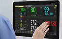 Monitor de Signos Vitales. Marca: Mindray, Modelo: Benevision N15