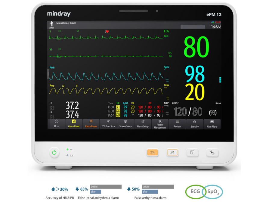Monitor de Signos Vitales preconfigurado marca Mindray, modelo ePM 12