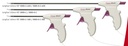 Pinza Bipolar Marca LINA Modelo POWERBLADE 5005-C (Curva)